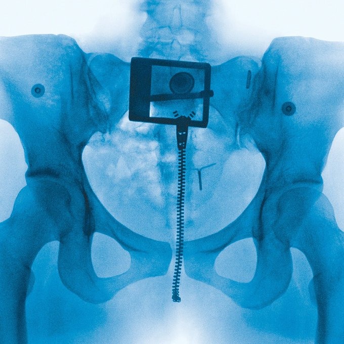 Lorde’s Virgin album artwork, a striking blue X-ray pelvis with a zipper, hints at her revolutionary 2025 music bombshell.